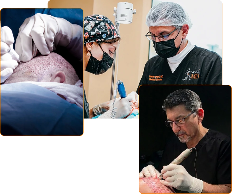 Dr. Imami performing FUE hair transplant procedures